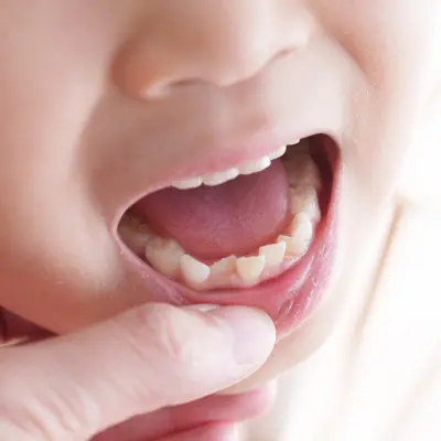 多くの症例に適用可能