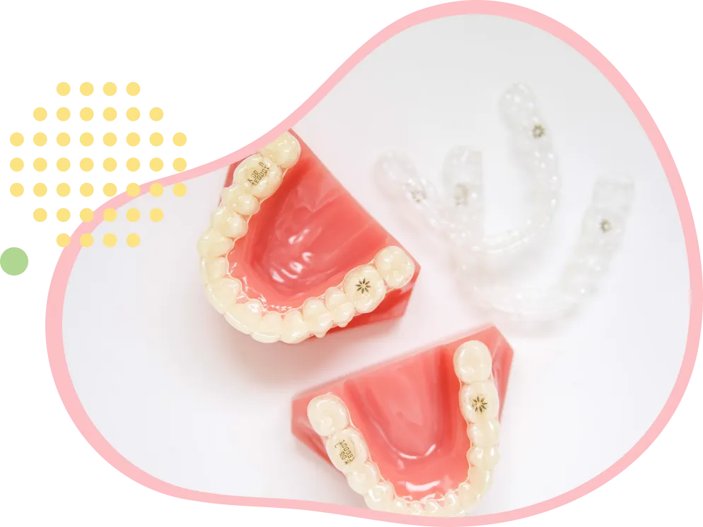 インビザラインファースト