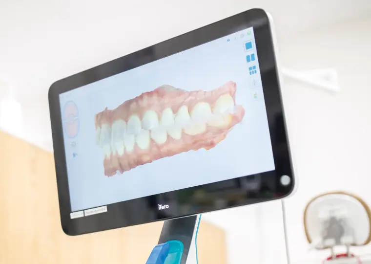 デジタルシミュレーション