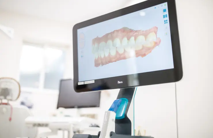 治療計画の説明・マウスピースの製作
