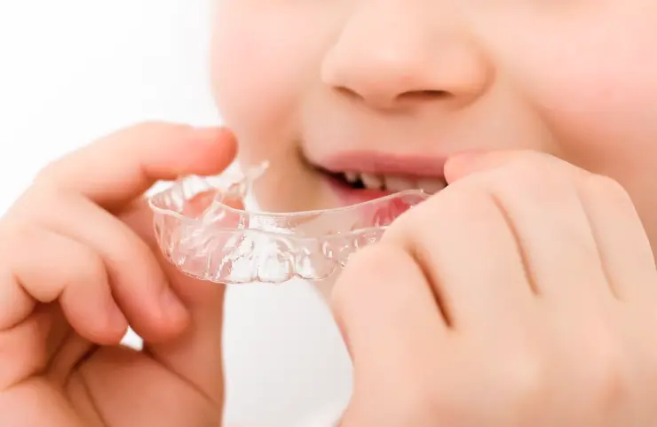 矯正治療の開始